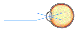 eyeanim1.gif